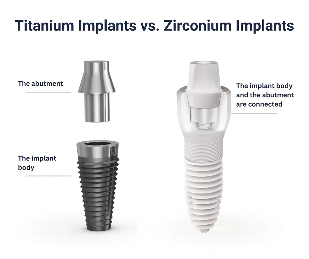 implants gallery
